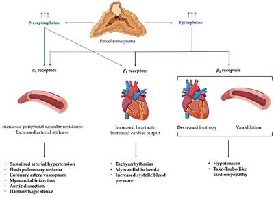 Prevention and management of hypertensive crises in children with pheochromocytoma and paraganglioma